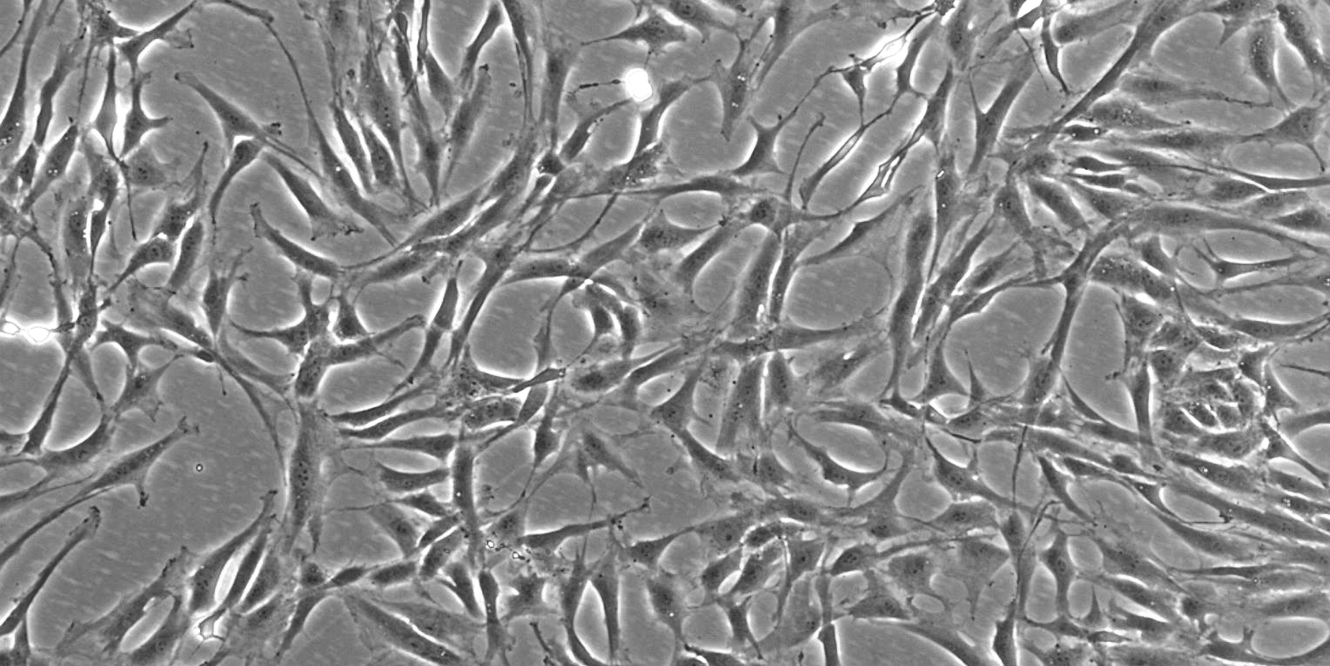hMSC-TERT_normale_Morphologie